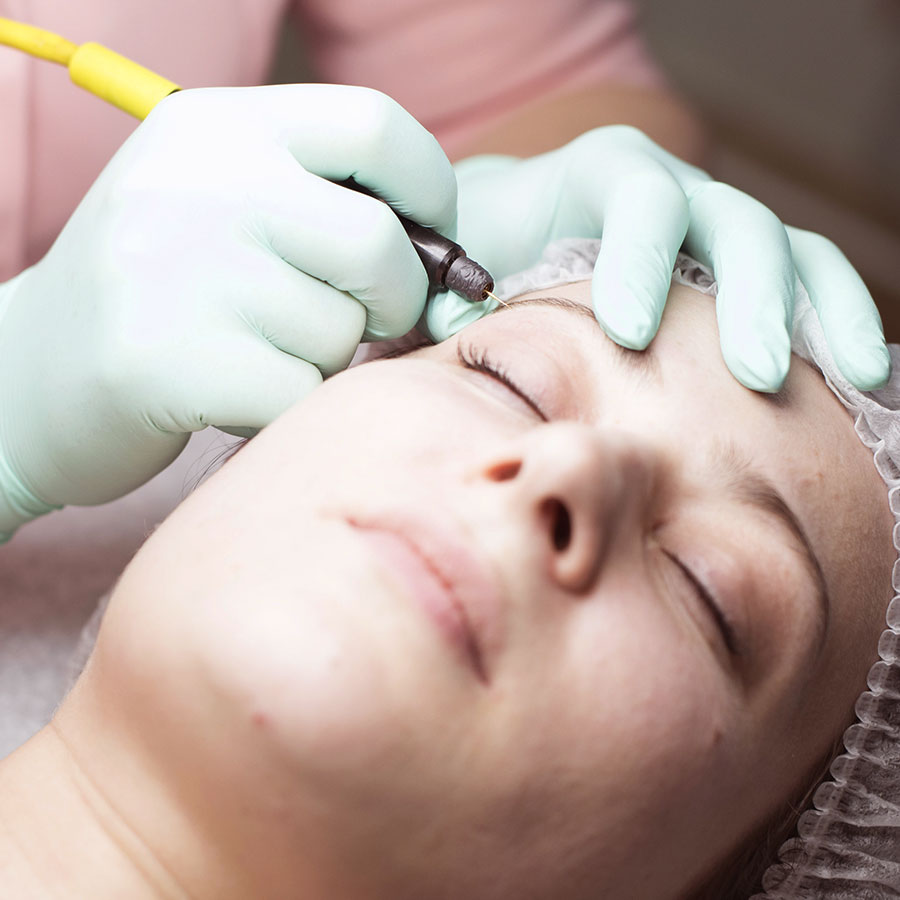 Electrolysis
